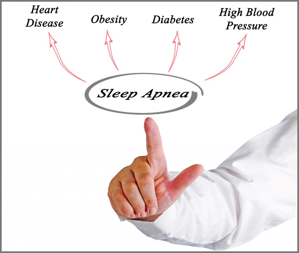 Untreated Sleep Apnoea Could Cut 10 To 20 Years Off Your Life