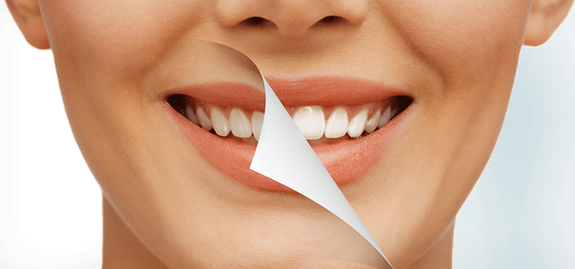 TEETH WHITENING
