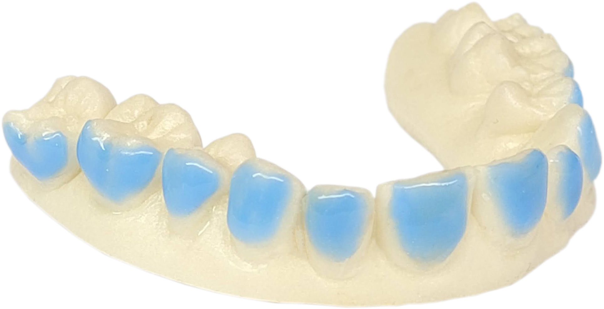 SleepPro Teeth Whitening - Custom Made Bleaching Trays - SleepPro Sleep Solutions