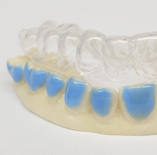 SleepPro Teeth Whitening - Custom Made Bleaching Trays - SleepPro Sleep Solutions